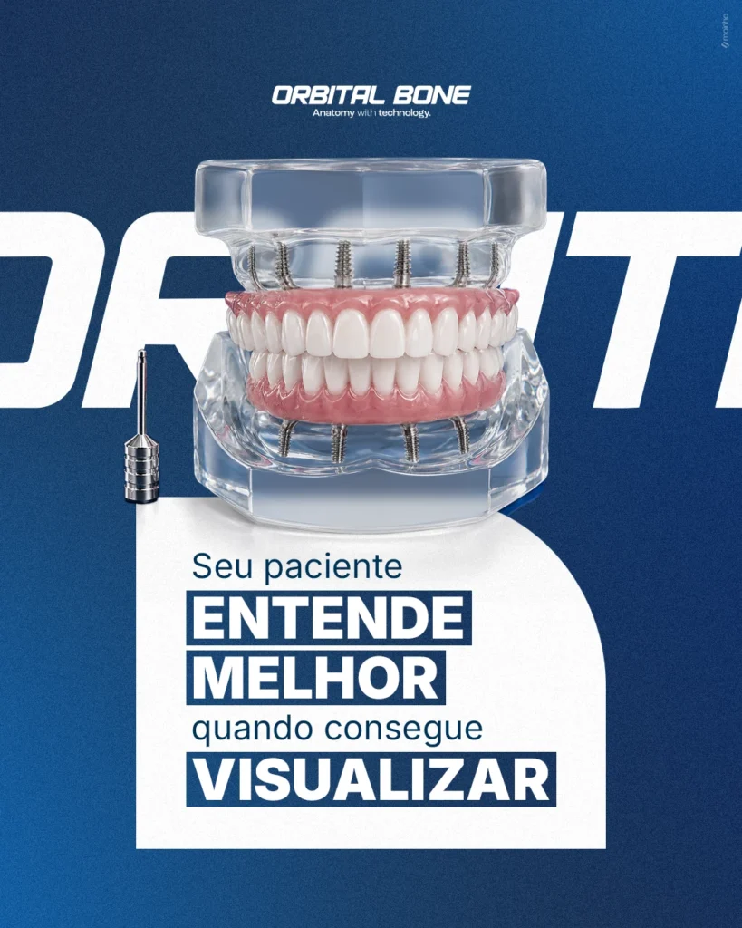 Peça de comunicação da Orbital Bone: POST 1