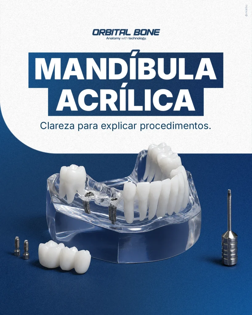 Peça de comunicação da Orbital Bone: POST 3