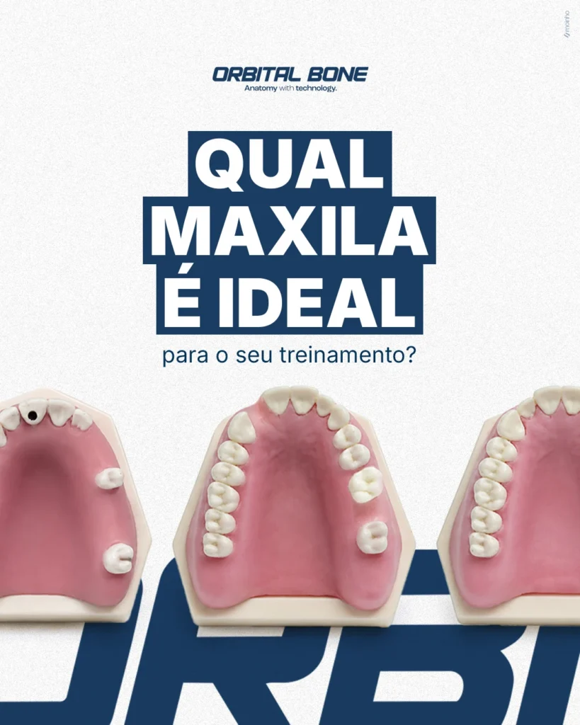 Peça de comunicação da Orbital Bone: POST 4