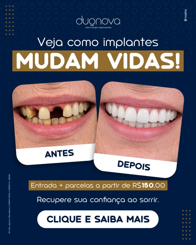 Anuncio da Duonova sobre aparelhos e estetica
